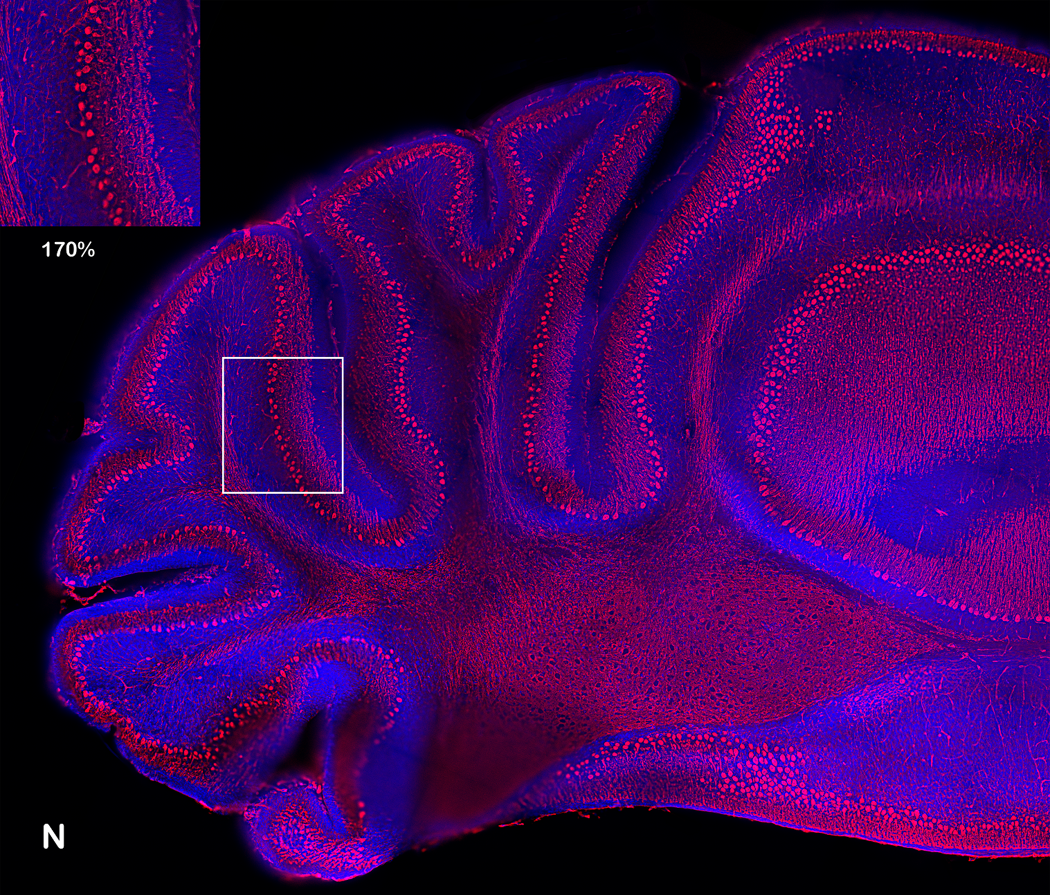 Immunohistochemistry marking of a mouse cerebellum